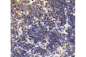 Immunohistochemistry analysis of paraffin-embedded mouse thymus using,MLLT11 (ABIN7074715) at dilution of 1: 4000 (MLLT11 antibody)