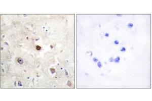 Immunohistochemistry analysis of paraffin-embedded human brain tissue, using p57KIP2 antibody. (CDKN1C antibody  (N-Term))
