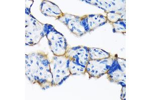Immunohistochemistry of paraffin-embedded human placenta using Dysferlin (Romeo) Rabbit mAb (ABIN7266868) at dilution of 1:100 (40x lens). (Dysferlin antibody)