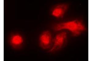 Immunofluorescent analysis of LKB1 staining in A431 cells. (LKB1 antibody  (C-Term))