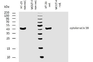 Western Blotting (WB) image for anti-Keratin 18 (KRT18) antibody (ABIN94279)