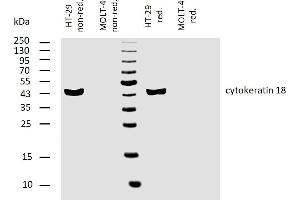 Western blotting analysis of human cytokeratin 18 using mouse monoclonal antibody C-04 on lysates of HT-29 cell line and MOLT-4 cell line (cytokeratin non-expressing cell line, negative control) under non-reducing and reducing conditions. (Cytokeratin 18 antibody)