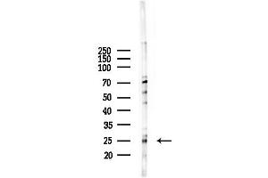 anti-Pallidin Homolog (PLDN) (C-Term) antibody