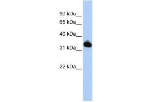 WB Suggested Anti-GALM Antibody Titration: 0. (GALM antibody  (N-Term))