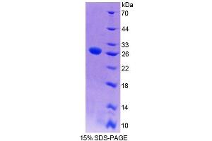 SDS-PAGE (SDS) image for WNT Inhibitory Factor 1 (WIF1) (AA 38-247) protein (His tag) (ABIN1981236)