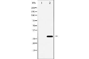 Western blot analysis of p27 Kip1 expression in EGF treated HeLa whole cell lysates,The lane on the left is treated with the antigen-specific peptide. (CDKN1B antibody  (C-Term))