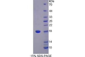 SDS-PAGE analysis of Human STAT5A Protein.