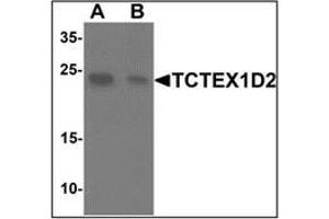 Western blot analysis of TCTEX1D2 in K562 cell lysate with TCTEX1D2at 1 ug/mL in (A) the absence and (B) the presence of blocking peptide. (TCTEX1D2 antibody  (N-Term))