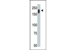 The anti-NCOR1 Pab (ABIN387976 and ABIN2844785) is used in Western blot to detect NCOR1 in mouse thymus tissue lysate.