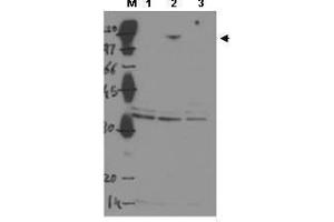 Western blot using  Protein A purified anti-ASPP2 to detect over-expressed ASPP2 in MCF-7 cells (Lane 2, arrowhead). (TP53BP2 antibody  (Internal Region))