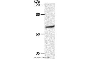 Western blot analysis of 231 cell, using SLC16A4 Polyclonal Antibody at dilution of 1:1200 (SLC16A4 antibody)