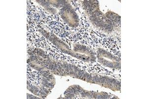 IHC analysis of EYA4 using anti-EYA4 antibody (ABIN7601063). (EYA4 antibody  (AA 28-205))