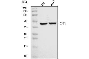 Western blot analysis of CD86 using anti-CD86 antibody (ABIN7601925).