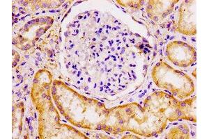 IHC image of ABIN7165313 diluted at 1:100 and staining in paraffin-embedded human kidney tissue performed on a Leica BondTM system. (ECT2 antibody  (AA 283-453))
