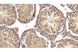 Detection of NR0B1 in Mouse Testis Tissue using Polyclonal Antibody to Nuclear Receptor Subfamily 0, Group B, Member 1 (NR0B1) (NR0B1 antibody  (AA 1-227))