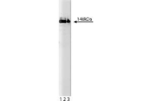 Western Blotting (WB) image for anti-phospholipase C, gamma 1 (PLCG1) (AA 82-100) antibody (ABIN967699) (Phospholipase C gamma 1 antibody  (AA 82-100))