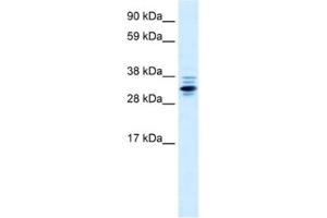 Western Blotting (WB) image for anti-Zinc Finger Protein 654 (ZNF654) antibody (ABIN2460661) (ZNF654 antibody)