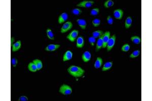 Immunofluorescent analysis of A549 cells using ABIN7143272 at dilution of 1:100 and Alexa Fluor 488-congugated AffiniPure Goat Anti-Rabbit IgG(H+L) (Crk antibody  (AA 40-196))