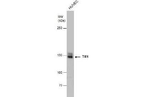 WB Image TIE1 antibody detects TIE1 protein by western blot analysis. (TIE1 antibody)