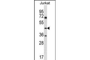 ASS1 Antibody (C-term) (ABIN656537 and ABIN2845801) western blot analysis in Jurkat cell line lysates (35 μg/lane). (ASS1 antibody  (C-Term))