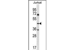 ASS1 Antibody (C-term) (ABIN656537 and ABIN2845801) western blot analysis in Jurkat cell line lysates (35 μg/lane).