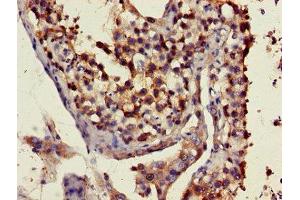 Immunohistochemistry of paraffin-embedded human testis tissue using ABIN7151350 at dilution of 1:100 (ART3 antibody  (AA 279-352))