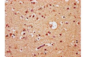 IHC image of ABIN7172459 diluted at 1:300 and staining in paraffin-embedded human brain tissue performed on a Leica BondTM system. (HNF1B antibody  (AA 539-704))