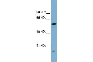 WB Suggested Anti-ALDH3A2 Antibody Titration:  0. (ALDH3A2 antibody  (Middle Region))