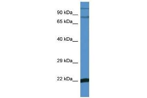 Western Blot showing Nfkbiz antibody used at a concentration of 1. (NFKBIZ antibody  (C-Term))