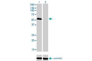 Western blot analysis of FOXA1 over-expressed 293 cell line, cotransfected with FOXA1 Validated Chimera RNAi (Lane 2) or non-transfected control (Lane 1). (FOXA1 antibody  (AA 367-472))