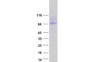 Validation with Western Blot (HEPACAM2 Protein (Transcript Variant 1) (Myc-DYKDDDDK Tag))