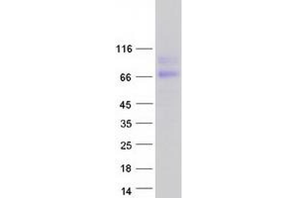 HEPACAM2 Protein (Transcript Variant 1) (Myc-DYKDDDDK Tag)