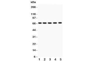Western blot testing of HNF1A antibody and Lane 1:  rat liver