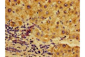 Immunohistochemistry (IHC) image for anti-Nuclear Factor of kappa Light Polypeptide Gene Enhancer in B-Cells 2 (NFKB2) (AA 263-439) antibody (ABIN7161777)