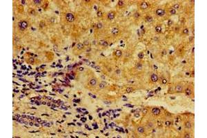 Immunohistochemistry of paraffin-embedded human liver tissue using ABIN7161777 at dilution of 1:100 (NFKB2 antibody  (AA 263-439))