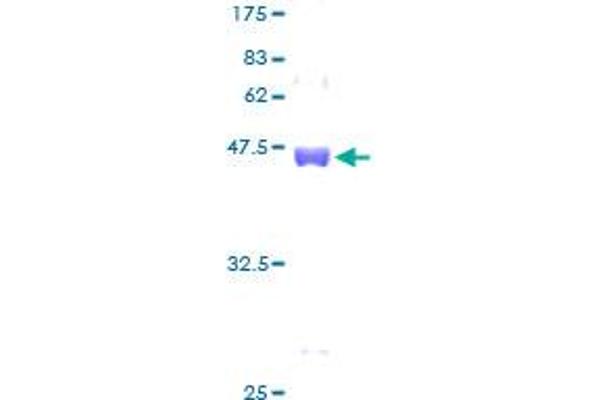 EIF1AX Protein (AA 1-144) (GST tag)