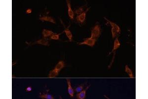 Immunofluorescence analysis of C6 cells using IQGAP1 Polyclonal Antibody at dilution of 1:100 (40x lens). (IQGAP1 antibody)