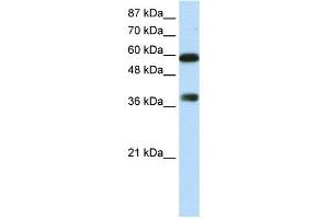 WB Suggested Anti-ARID3B  Antibody Titration: 0. (ARID3B antibody  (C-Term))