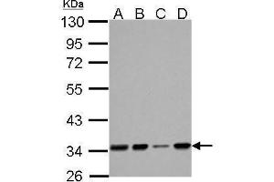 Western Blotting (WB) image for anti-Hydroxyacyl-CoA Dehydrogenase (HADH) antibody (ABIN2856051)