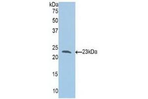 Detection of Recombinant Slit1, Human using Polyclonal Antibody to Slit Homolog 1 (Slit1) (SLIT1 antibody  (AA 647-835))
