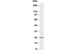 Western blot testing of PMVK antibody and rat heart tissue lysate (PMVK antibody  (Middle Region))