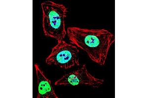 Fluorescent confocal image of Hela cell stained with HDAC2 Antibody (Center) (ABIN653718 and ABIN2843029).