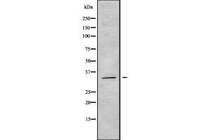 Western blot analysis OR5AT1 using COLO205 whole cell lysates (OR14A16 antibody  (Internal Region))