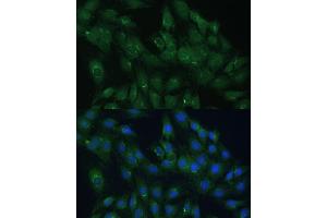 Immunofluorescence analysis of C6 cells using  Polyclonal Antibody (ABIN7265476) at dilution of 1:100 (40x lens). (ARL1 antibody  (AA 62-181))