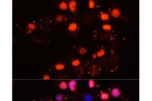 Immunofluorescence analysis of HeLa cells using HMGB2 Polyclonal Antibody at dilution of 1:100. (HMGB2 antibody)