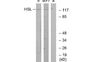 Immunohistochemistry analysis of paraffin-embedded human tonsil tissue using HSL (Ab-552) antibody. (LIPE antibody  (Ser552))
