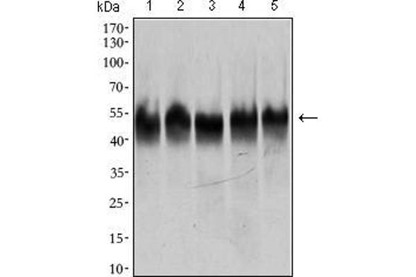 TUBB2A Antikörper  (AA 25-187)