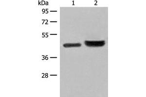 Western blot analysis of 231 cell and Human fetal liver tissue lysates using INPP1 Polyclonal Antibody at dilution of 1:500 (INPP1 antibody)