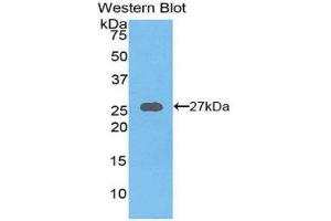 Western Blotting (WB) image for anti-Axin 1 (AXIN1) (AA 654-863) antibody (ABIN1858101)