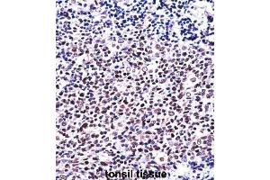 Immunohistochemistry (IHC) image for anti-Nuclear Factor of Activated T-Cells, Cytoplasmic, Calcineurin-Dependent 1 (NFATC1) antibody (ABIN2997610)